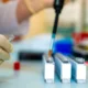 hplc-yuksek-performansli-sivi-kromatografisi